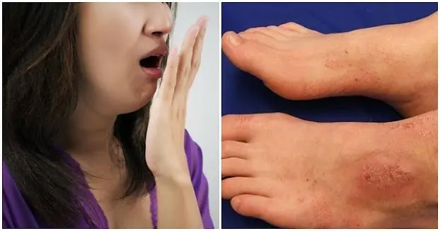8 อาการไตวาย หากไม่ใส่ใจอาจต้องฟอกไตตลอดชีวิต