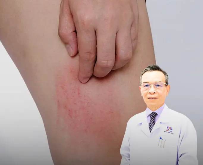 อาการคันบริเวณ 4 จุดดังกล่าวบนร่างกาย อาจเป็นสัญญาณของโรคมะเร็งตับ