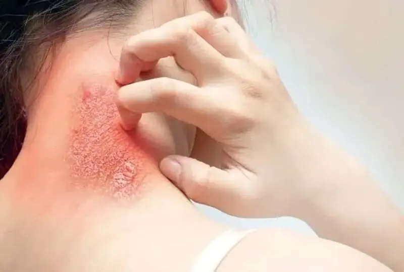4 สัญญาณ “ไ.ตอ่อนแรง” ค่อย ๆ โจมตีคนวัยหนุ่มสาว – 90% ไม่รู้ตัว!