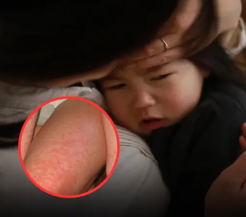"ไข้รากสาดน้อย" กับ "ไข้รากสาดใหญ่" ต่างกันอย่างไร? แบบไหนอันตรายกว่า?