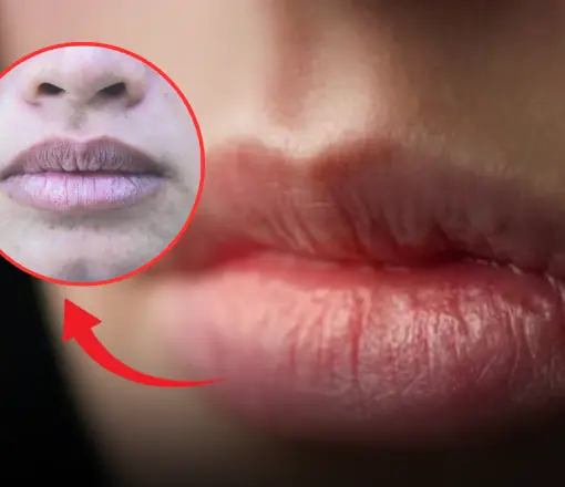 เช็กเองง่ายๆ "สีริมฝีปาก" บอกโรคได้ สัญญาณจากร่างกายที่ไม่ควรมองข้าม