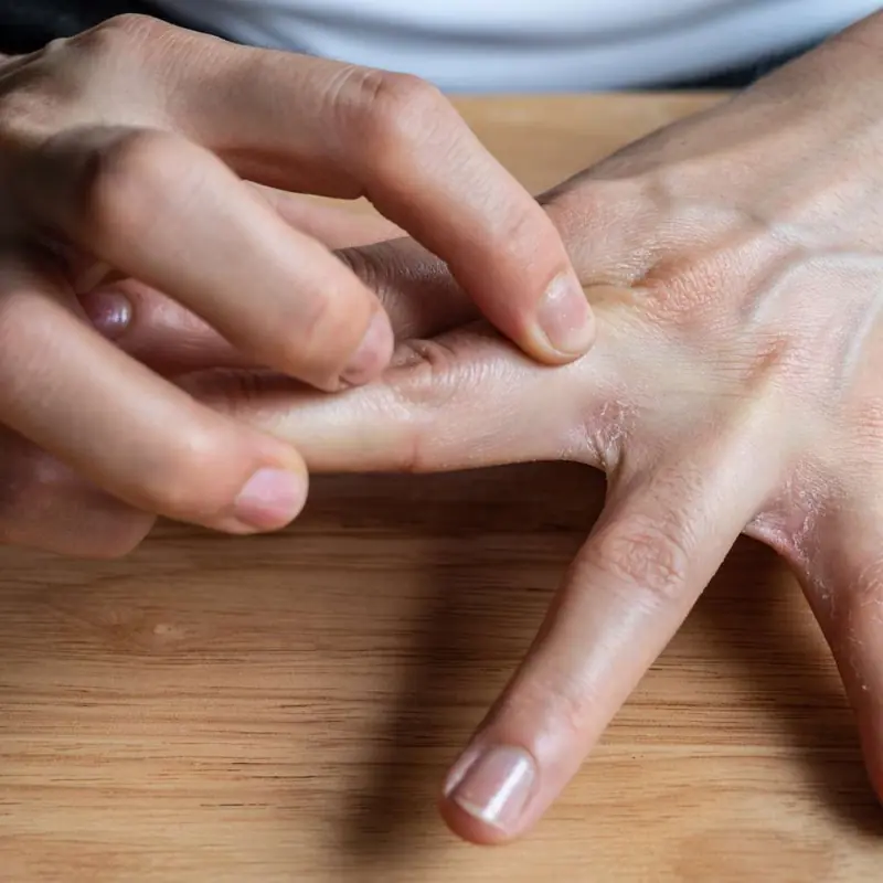 ระวังให้ดี! อาการคันตามร่างกายบางจุด อาจไม่ใช่ภูมิแพ้ แต่เป็น “สัญญาณเตือนโรคตั.บ”