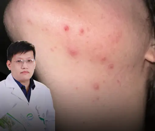 8 สัญญาณ “เหมือนปกติ” แต่จริง ๆ แล้วอาจเป็นมะเร็งปอด!