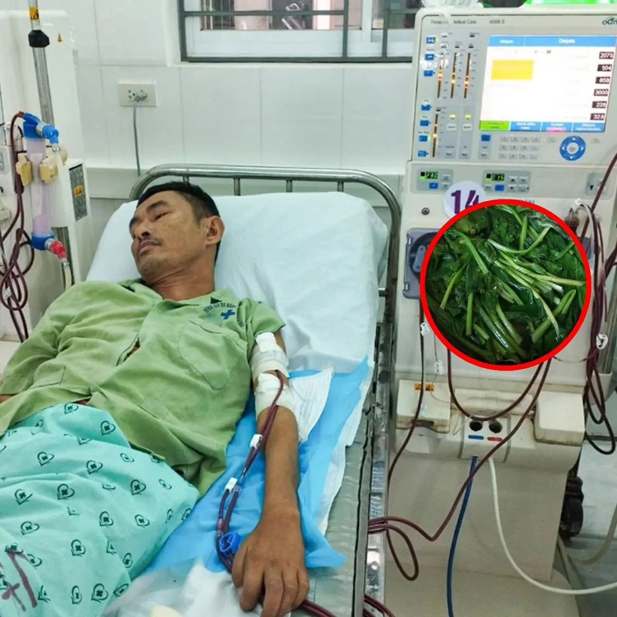 ảnh này ไม่มีใครคาดคิด แค่กินผัก 1 จาน ต้องฟ.อ.ก.ไ.ตตลอดชีวิต ห.ม.อย้ำผักเหล่านี้ “ต้องลวก” ก่อนกิ