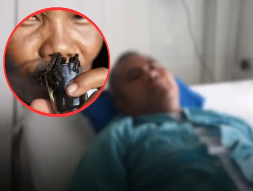 ไม่ใช่หนังงู แต่คือลำไส้มนุษย์ คนไข้เผยสิ่งที่ "ดื่มทุกวัน" หมอฟังจบรีบเตือน เสี่ยงโรคร้า