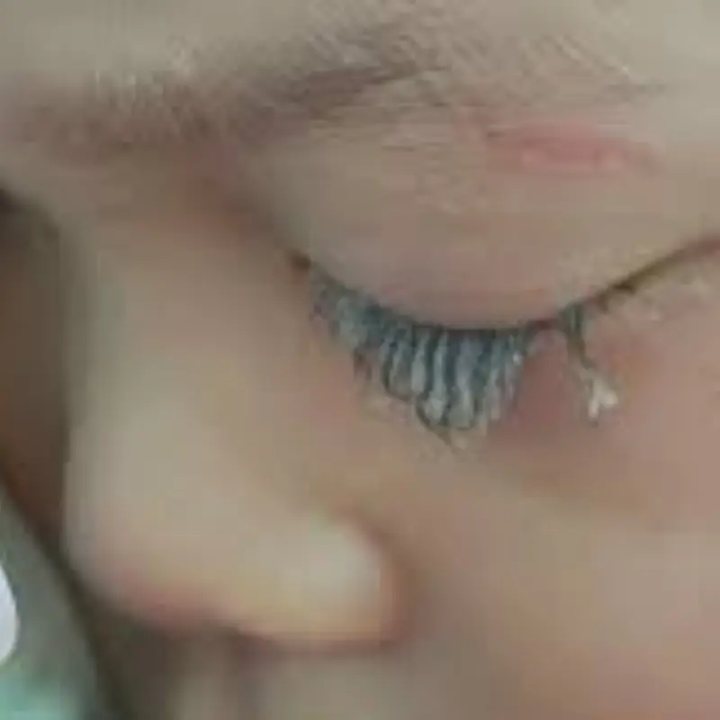 เด็กชายวัย 3 ขวบถูกกาว 502 หยดเข้าตา แม่ตั้งสติ “30 วินาทีทอง” ช่วยลูกพ้นอันตรายได้ทัน