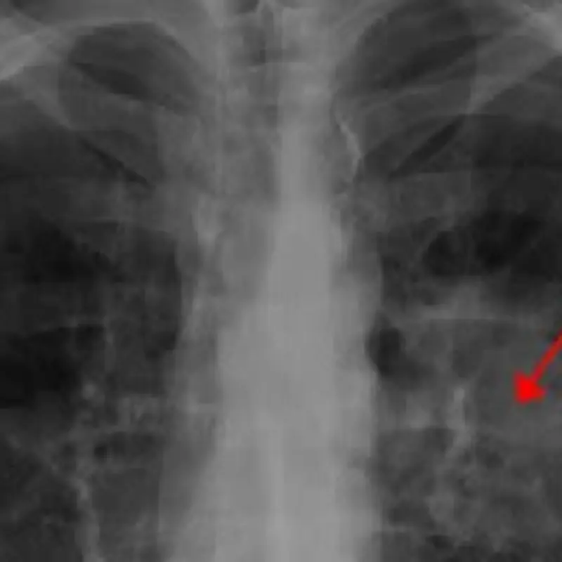 เธอกล่าวว่า “ดีใจที่ไม่เป็นม.ะ.เ.ร็.ง แต่ก็ไม่คาดคิดว่าสิ่งเล็กๆ แบบนี้จะทำให้ทรมานมานานข