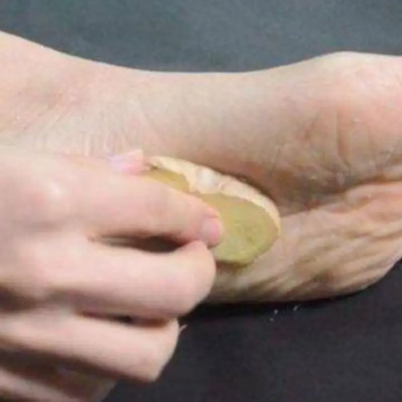 4 ประโยชน์น่าทึ่งจากการ “แปะขิงไว้ที่ฝ่าเท้าก่อนนอน” เคล็ดลับโบราณที่หลายคนยังไม่รู้