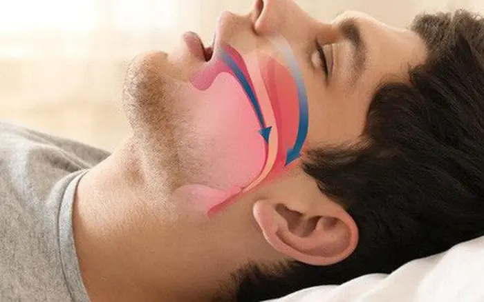 ใครที่มักมีอาการน้ำลายไหลขณะหลับ ควรใส่ใจให้มาก