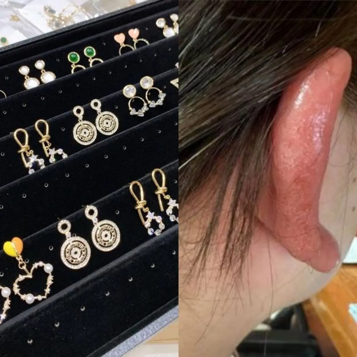 เตื.อน! "ต่างหู" ที่ขายดีในออนไลน์ เปิดประตูเชื้อ.โรคเ.ข้.าร่าง.กาย ไม่ใช่แค่แพ้ แต่อาจถึงขั้