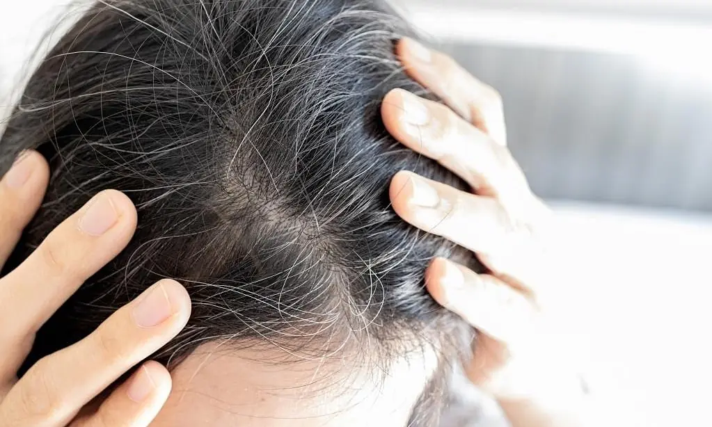 กลุ่มอาหารที่ทานบ่อยๆ ช่วยป้องกันไม่ให้ผมดำหงอก