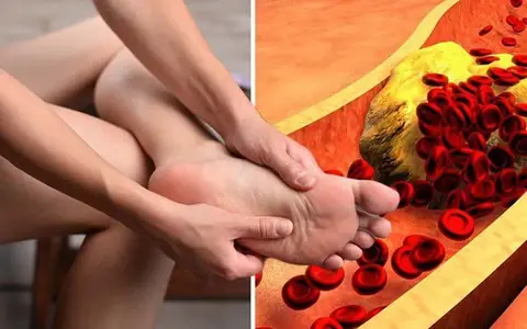 5 ประเภทอาหารกำจัดกรดยูริกได้อย่างรวดเร็วและปกป้องไต หาได้ง่าย ๆ ทั้งหมด