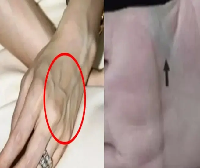 เห็นใครที่มีกล้ามเนื้อขึ้นเป็นเส้นสีเขียว อย่ามองข้าม! บอกเขาเรื่องนี้ไว้… อาจช่วยชีวิต