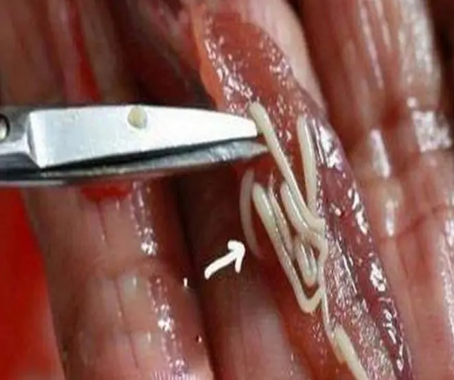 5 เมนูยอดนิยมที่หลายคนชอบกิน... แต่ก็เป็นของโปรดของ “ปรสิต” ด้วยเช่นกัน