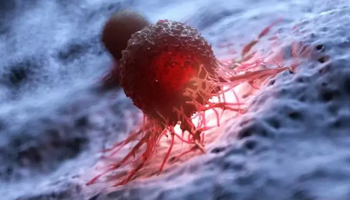 ระวัง! 5 จุดบนร่างกายคล้ำผิดปกติ อาจบ่งบอกถึงเซลล์มะเร็งภายใน