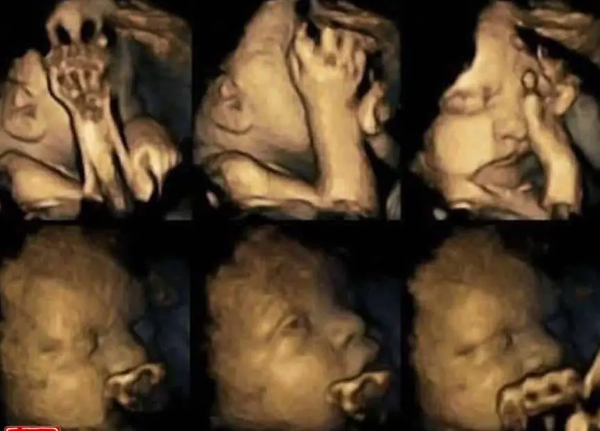 สามีสูบบุหรี่ ภรรยาสุขภาพย่ำแย่ ลูกน้อยยังไม่ทันลืมตาก็ต้องเริ่มเรียนรู้การอดทน