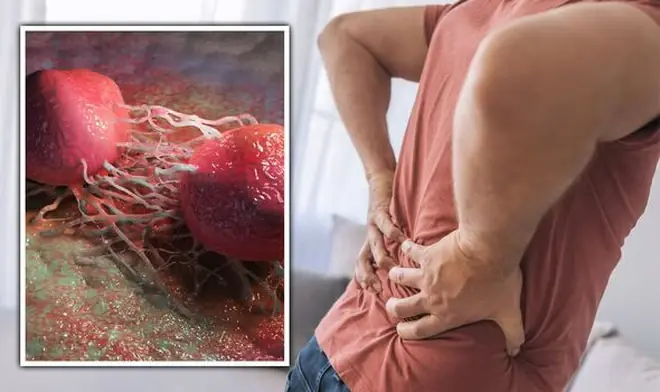 ชายจำนวนมากขึ้นเรื่อย ๆ กำลังป่วยเป็น ม.ะเ.ร็.งต่.อม.ลูก.หม.าก เห็นสัญญาณเหล่านี้แล้ว อย่ามอง