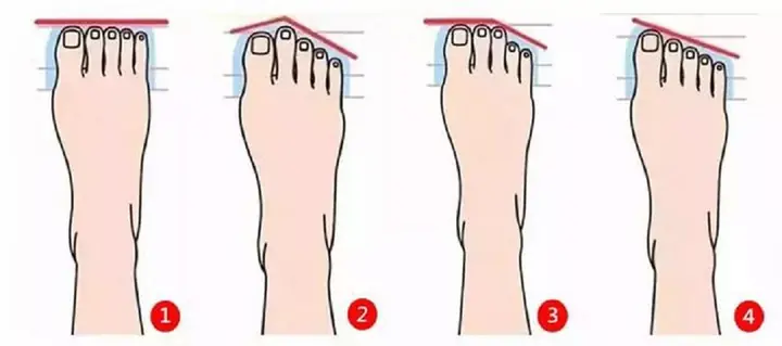 ดูจาก “รูปเท้า” ทำนายอนาคต — คุณจะเป็น “นกฟีนิกซ์” โบยบินสูง หรือ “ทาสสาว” ตลอดกาล