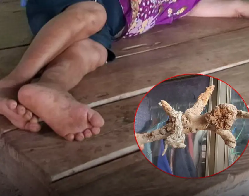 ผัววอน 'หมอปลา' ช่วยด้วย! เมียมีพฤติกรรมแปลก กินหมูดิบ เดินแก้ผ้า มีกลิ่นเหม็นเน่าคล้ายศพออ