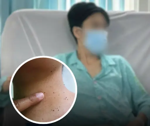 หญิงอ่วม ตรวจเจอมะเร็ง 3 ชนิดพร้อมกัน เพราะ "จุดเล็กๆ บนผิวหนัง" แพทย์ชี้อย่าชะล่าใจ