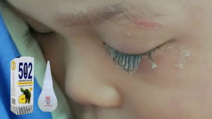 เด็กชายวัย 3 ขวบถูกกาว 502 กระเด็นเข้าต.า — การตัดสินใจของแม่ใน “30 วินาทีทอง” ช่วยชีวิตลูกจากก