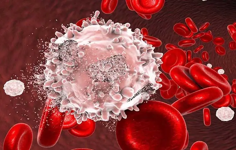 หากในร่างกายมีเซลล์มะ.เร็.งแฝงอยู่ — ตอนกลางคืนมักแสดงออก 3 อาการนี้ แต่หลายคนกลับมองข้ามแ