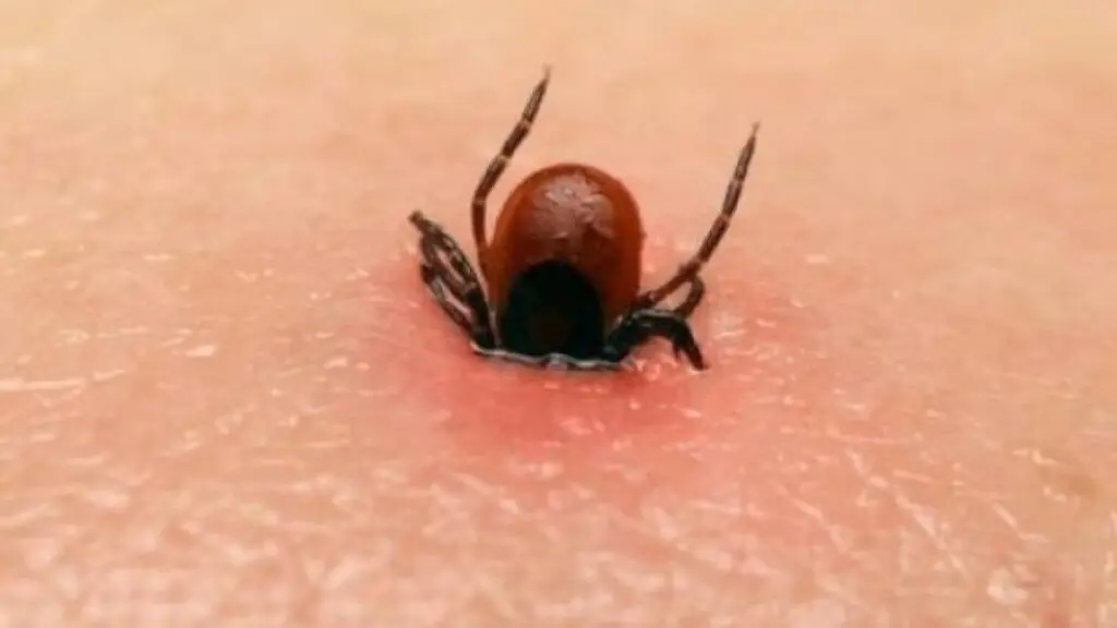 เห็บหมากั.ดคนในบ้าน 3 คน เสี.ยชี.วิต 2 ราย — ถ้าดูแลไม่สะอาด อย่าเลี้ยงเลย! เพราะมันเต็มไปด้วยเ