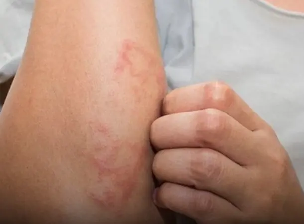 หากร่างกายของคุณปรากฏ 1 ใน 5 สัญญาณเหล่านี้ ควรตรวจสุขภาพทันที!