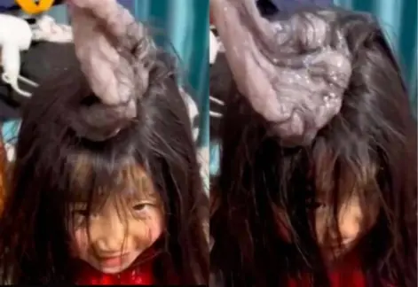 แม่ตกใจ! ลู.ก.ส.า.วกลับจาก รร. "กุมหัวร้องไห้" เห็นอะไรติดเต็มหัว พาไป รพ.ด่วน