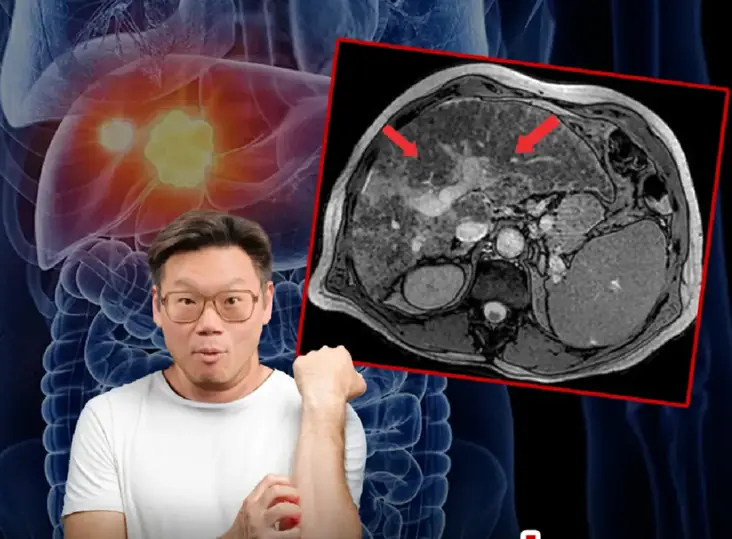 หมอเตือนด่วน "คันทั้งตัวแต่ไม่มีผื่นขึ้น" ใครมีอาการนี้ ระวัง