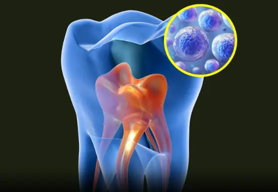 ฟันคุดอาจกลายเป็นขุมทรัพย์แห่งการแพทย์สมัยใหม่ – แหล่งเซลล์ต้นกำเนิดที่สามารถฟื้นฟูสมอ