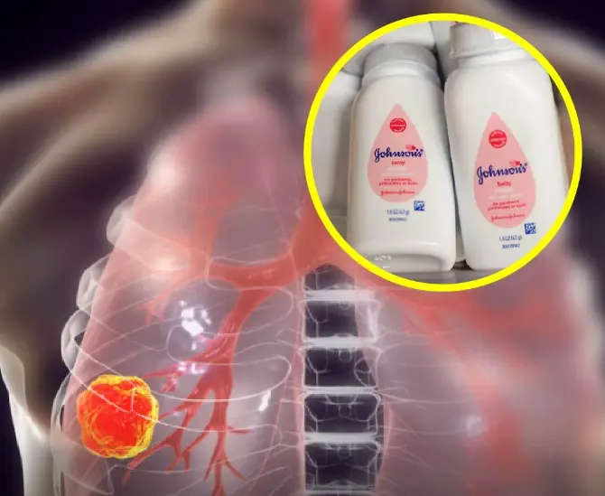 Johnson & Johnson ถูกปรับเกือบพันล้าน! เพราะแป้งทัลคัมปนเปื้อนแร่ใยหิน?