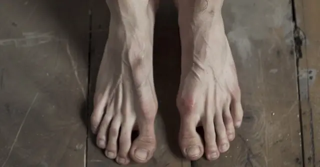 เมื่อมะเร็งเริ่มคุกคามร่างกาย ร่างกายอาจส่งสัญญาณเตือน 4 ประการที่ “ขา” หากคุณมีอาการเหล่