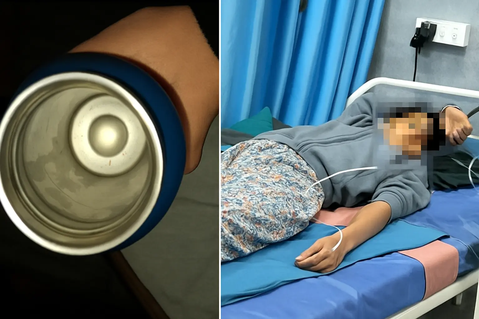 หญิงวัย 25 ปีได้รับอัน.ตร.ายจากการใช้แก้วเก็บความร้อนผิ.ดวิ.ธี กลายเป็น “แก้วอัน.ตร.าย” ที่หล