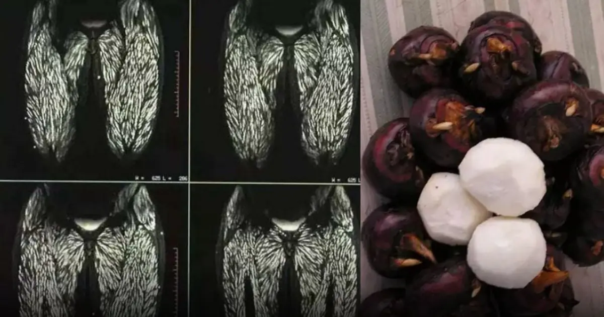 การกินเพียง 1 ชิ้น เทียบเท่ากับการที่ ปรสิตกว่า 100,000 ตั.วเ.ข้า.สู่ร่.างกาย แต่หลายคนกลับไม่ใส่