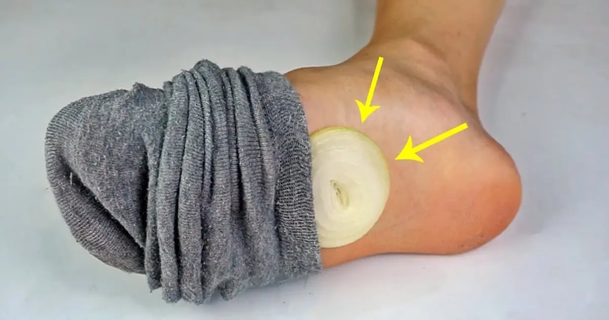 วางหัวหอมที่ฝ่าเท้าก่อนนอน อาจช่วยให้ร่างกายได้รับประโยชน์มากกว่าที่คิด