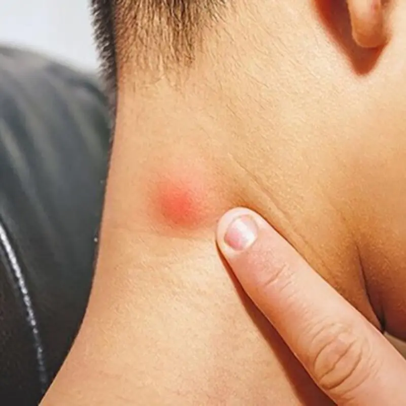 มะเร็งไม่เคยมาเงียบ ๆ! ร่างกายส่ง 5 สัญญาณเตือนสำคัญ หากพบอย่านิ่งนอนใจ รีบตรวจทันที