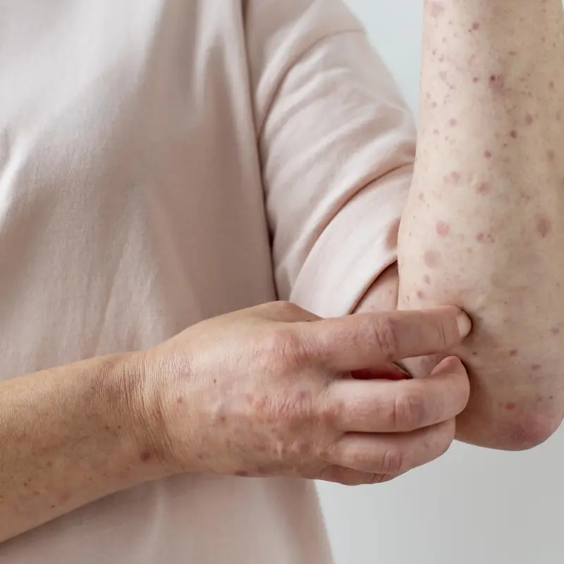 อย่ามองข้าม! 2 กลิ่น 2 ตำแหน่ง 2 จุดแดง สัญญาณเตือนโรคร้าย ตรวจพบเร็วรักษาทัน