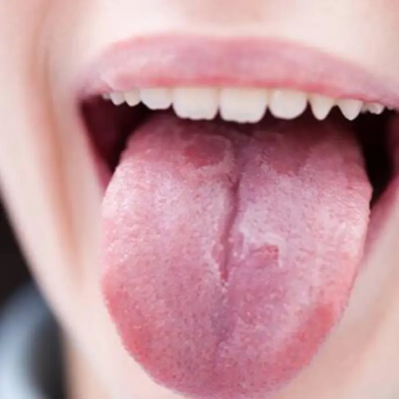 5 สิ่งที่ลิ้นสามารถบอกเกี่ยวกับสุขภาพได้: ตั้งแต่ม.ะ.เ.ร็.งไปจนถึงความเสี่ยงโ.ร.ค.ห.ลอดเลือดส