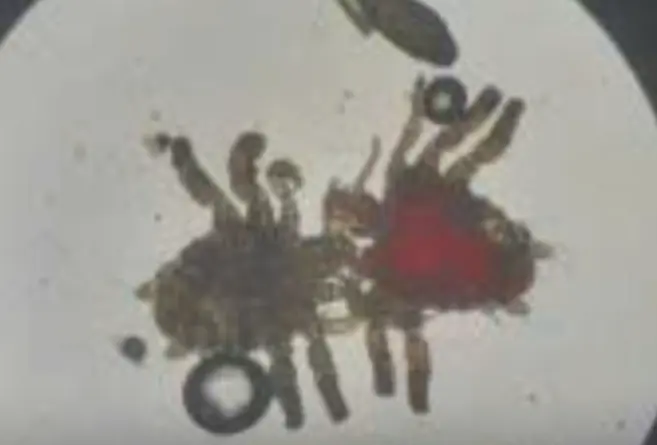 คันมานานกว่า 1 ปี ชายคนหนึ่งไปพบแพทย์ และพบความจริงที่ไม่น่าเชื่ออยู่ภายใน