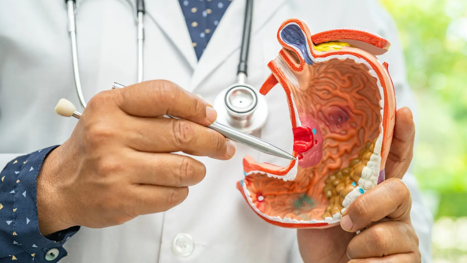 7 สัญญาณของมะ.เร็.งกระเ.พาะอาหา.รระยะเริ่มต้น ที่ทุกคนควรรู้ไว้ ระวังอาจลุกลามไปไกล