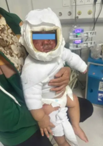 อุบัติเหตุเพียงเสี้ยววินาที ทำให้ทารกวัย 9 เดือนต้องถูกนำส่งโรงพยาบาลฉุกเฉิน