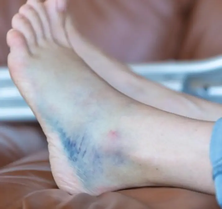 อย่านิ่งนอนใจ! เบาหวานอาจกำลังคุกคาม หากมีอาการแปลกๆ เหล่านี้บ่อยถึง 5 ข้อ