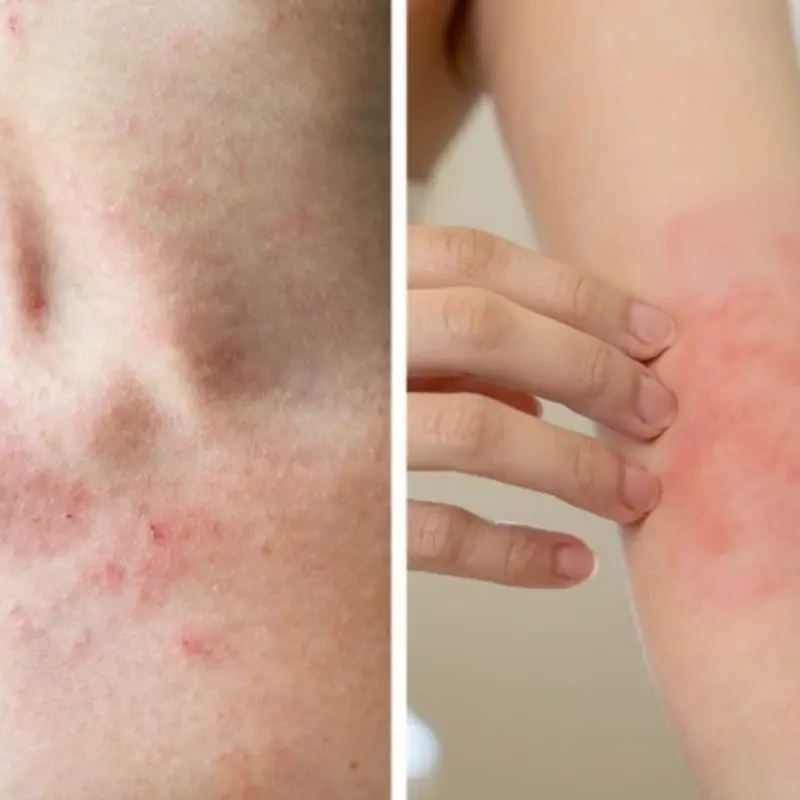 11 สัญญาณเตือนจากร่างกาย ที่ไม่ควรมองข้าม