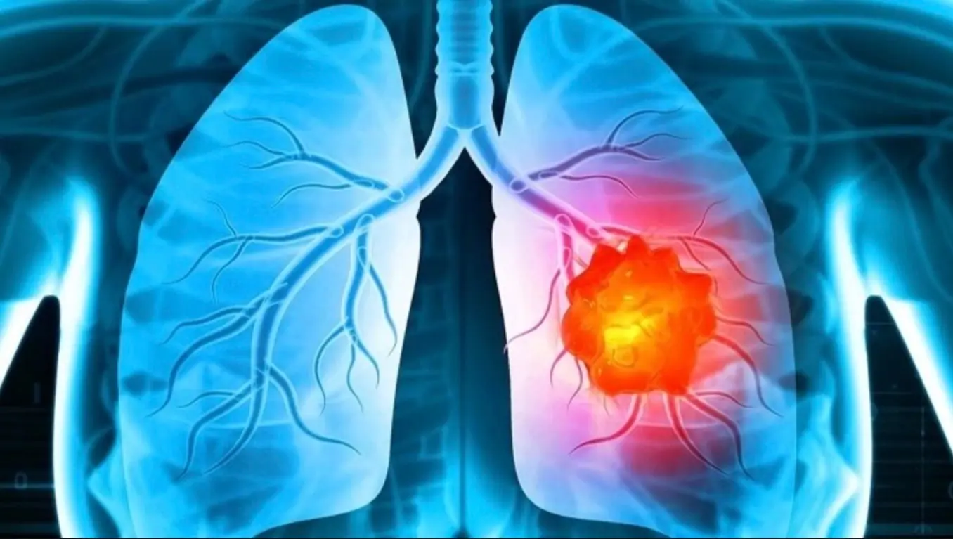 คำเตือนมะ.เร็.งป.อด: หากตื่นนอนตอนเช้าแล้วพบ 4 อาการนี้บ่อย ๆ