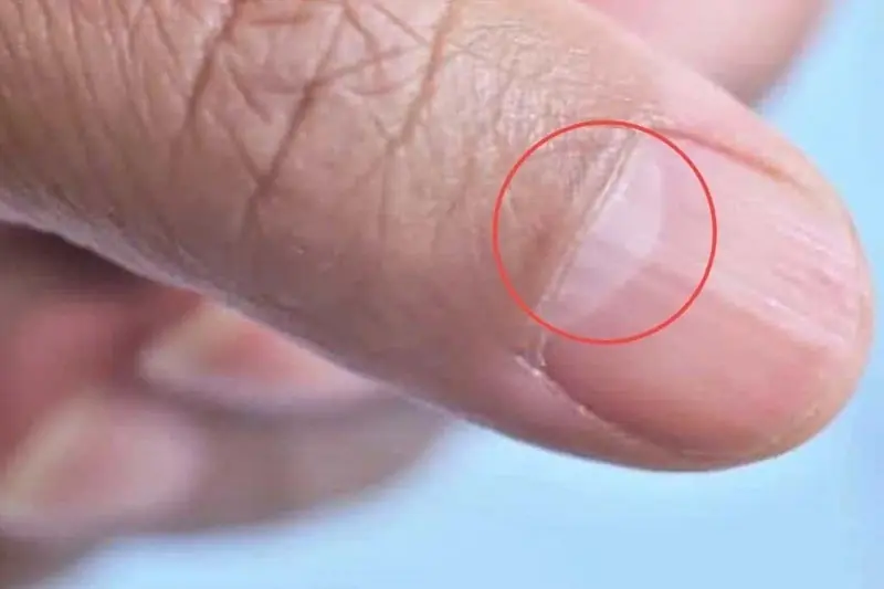 คนที่มีสุขภาพแข็งแรงและอายุยืน มักมี 4 สัญญาณบนฝ่ามือของตนเอง: คุณมีอยู่กี่ข้อ?