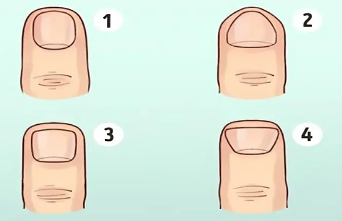 ใช้เวลาเพียง 1 วินาทีดูรูปทรงนิ้วมือ ก็รู้ลักษณะนิสัยของแต่ละคนได้ทันที