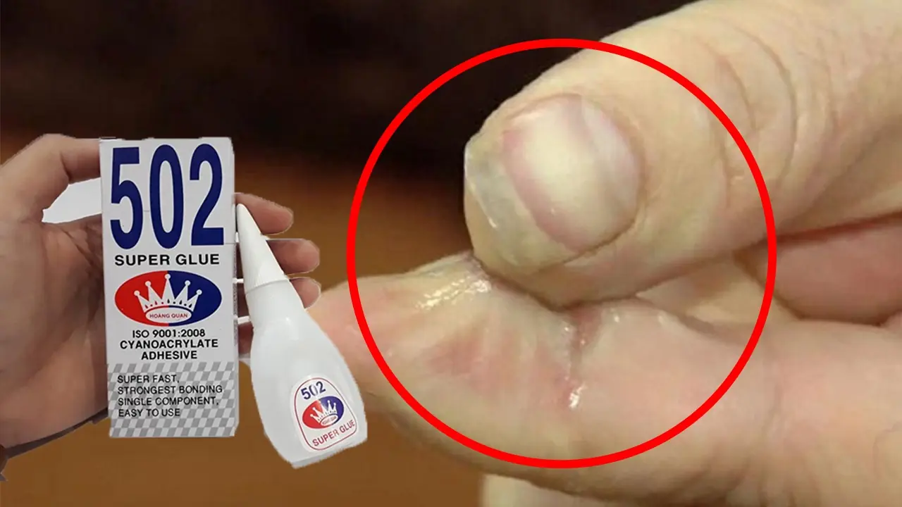 เคล็ดลับกู้ชีพนิ้วโป้ง! วิธีกู้คืนผิวสวยเมื่อโดนกาวตราช้างติดมือฉบับเร่งด่วน