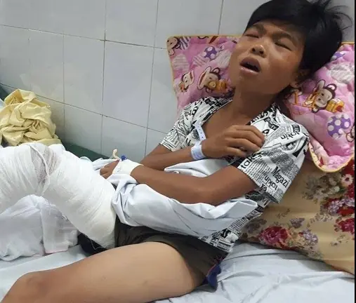 คิดว่าแค่ไข้หวัดใหญ่! ด.ช.วัย 12 ปี ไข้กลับ หมอดึงขากางเกงดูถึงกับร้อง สั่งส่ง ICU ด่วน