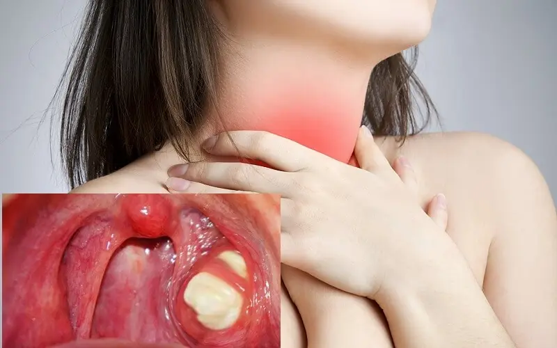 สาเหตุหลักที่ทำให้มีเสมหะมากเกินไปในลำคอมีอะไรบ้าง?